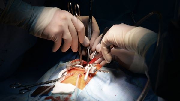 В России впервые провели сложнейшую операцию на сердечном клапане 0